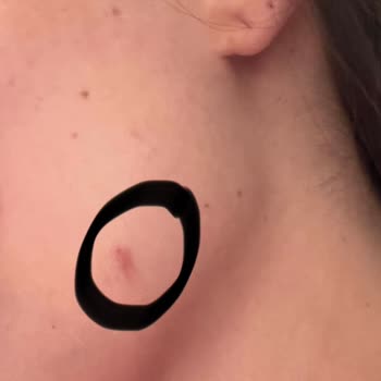 Aden Beauty Estetik ve Güzellik Merkezi Yüz Ve Kol Lazer Epilasyon