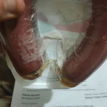 A101 Bozuk Et Ürünleri Ve Ücret İadeleri