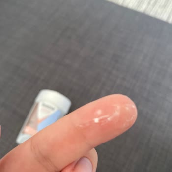 Rexona Deodorant Bozuk Ürün