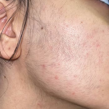Luxury Beauty Center Güzellik Merkezi Yüzümü Ve Tüm Vücudumu Mahvetti
