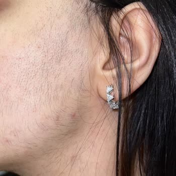 Luxury Beauty Center Güzellik Merkezi Yüzümü Ve Tüm Vücudumu Mahvetti