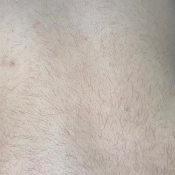 Luxury Beauty Center Güzellik Merkezi Yüzümü Ve Tüm Vücudumu Mahvetti