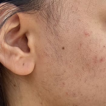 Luxury Beauty Center Güzellik Merkezi Yüzümü Ve Tüm Vücudumu Mahvetti