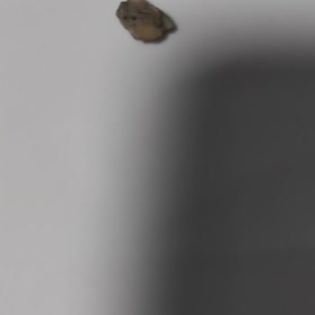 Duru Sabun İçerisinden Çıkan Taş