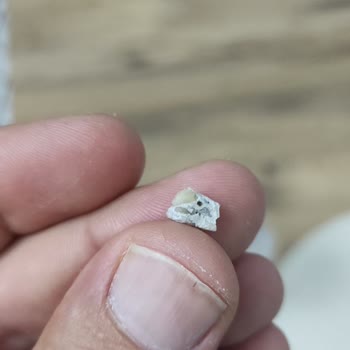 Duru Sabun İçerisinden Çıkan Taş