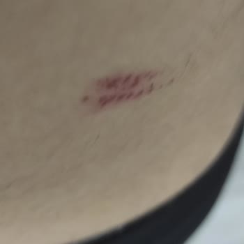 Duru Sabun İçerisinden Çıkan Taş