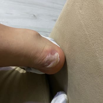 My Feet Suffered From Puma Shoes