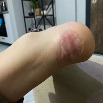 My Feet Suffered From Puma Shoes