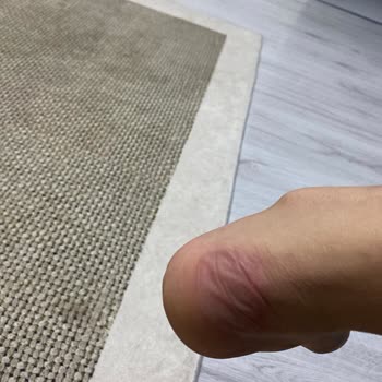 My Feet Suffered From Puma Shoes