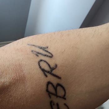 Lady Loca Güzellik Merkezi Dövme Silme Yalanı