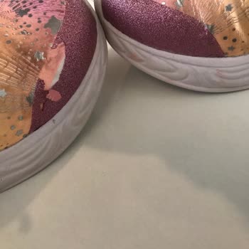 Skechers Çocuk Spor Ayakkabısı Burun 2 Günde Soyuldu