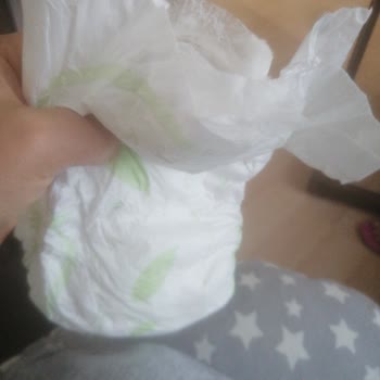 Önlem Çocuk Bezi Yırtık Bez Çıkması