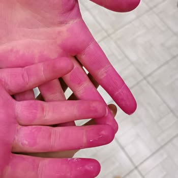 Dieci Hair Saç Boyası Faciası