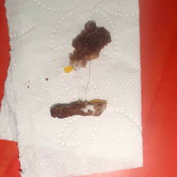 Mopaş Marketleri İnsan Sağlığı İle Oynuyor