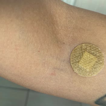 Özel Ortadoğu Hastanesi (Mersin) Onkoloji Kan Alımı