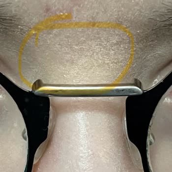 Flormar Stay Perfect Concealer Kapatıcı Oksitlendi