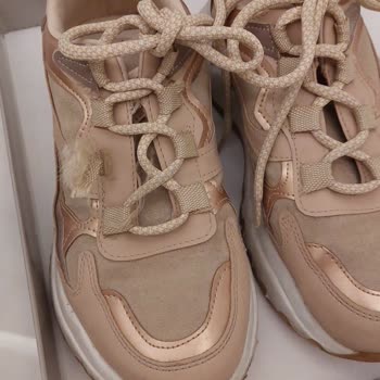 Hotiç Spor Ayakkabının Bağcık Bantları Nasıl Kullanıcı Hatası Olur?