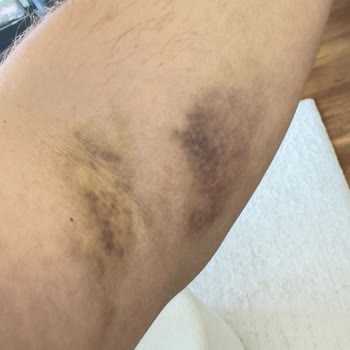 Memorial  Ataşehir'deki Check-up Hizmeti