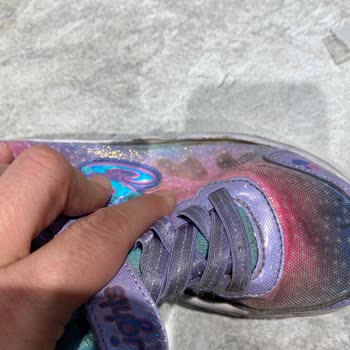 Skechers Shoes Torn Within 15 Days