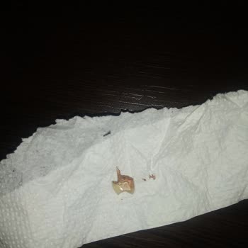 İstanbul Eyüp Ağız Ve Diş Sağlığı Merkezi'indeki Doktor Dişimi Kırdı