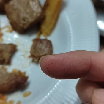 A101 Kombinet Köfteden Kıl Çıktı