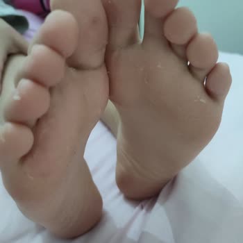 Skechers Ayakkabının Mantar Yapması