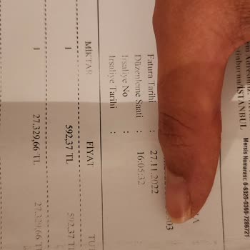 Samsung Telefon Ekran Titremesi Ve Ses