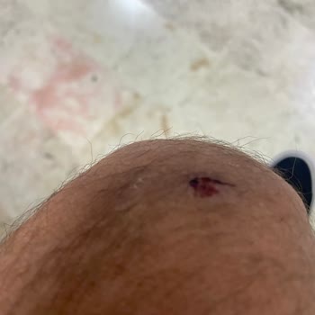BinBin Markasının Bakım Yapmaması Üzerine