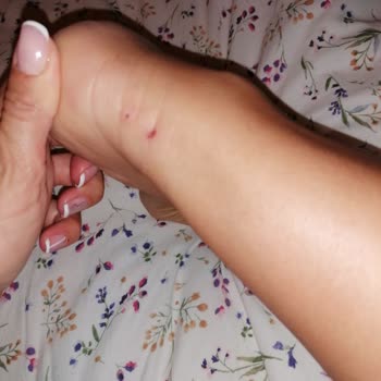 Skechers Ayakkabının Rahatsızlığı Firma Mağdur Etti