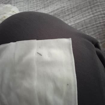 Molfix Islak Mendil Bir Şeyler Çıkması