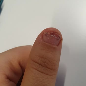 Sena Gökdağ Beauty Tırnağım Morardı Bir Günde Kanadı Hemen