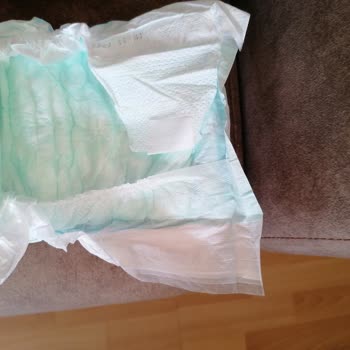 Molfix Bebek Bezi Hatalı