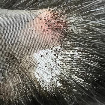 Oluşum Protez 'de Saç Hizmetinden Memnun Kalmadım