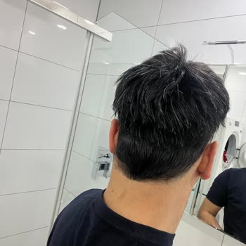 Oluşum Protez 'de Saç Hizmetinden Memnun Kalmadım