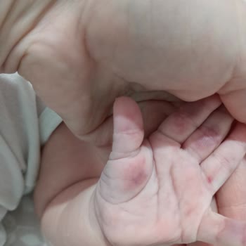 Özel Aritmi Osmangazi Hastanesi Kan Alırkenki Sorumsuzluk