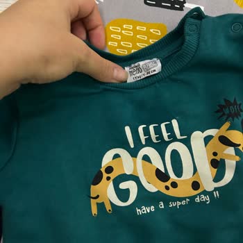 ebebek Boyası Bebeğin Tenine Çıkan Kazak