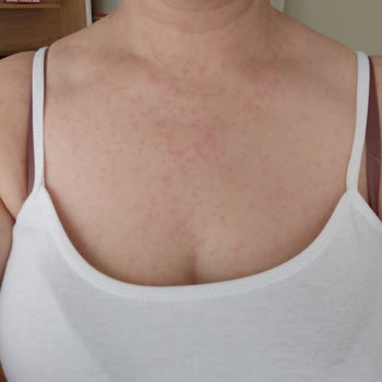 Abdi İbrahim İlaç Yan Etkisi