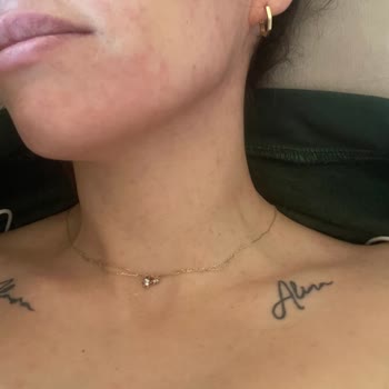 Abdi İbrahim İlaç Yan Etkisi