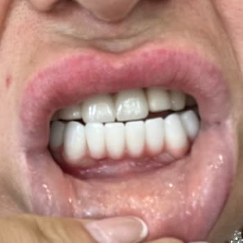 DF Dental Batman Df Diş Tedavi Süreci