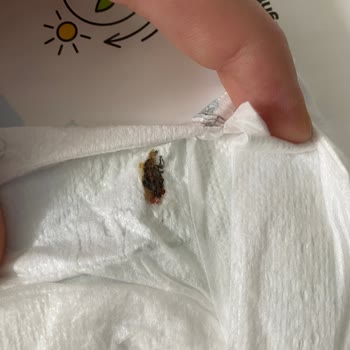 Sleepy Bezlerde Böcek Kalıntısı