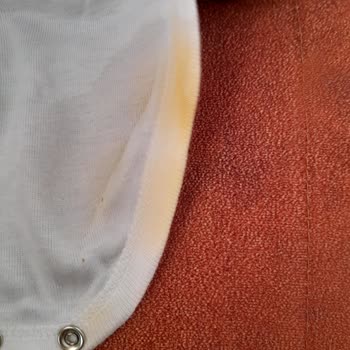 Molfix Bebek Bezi Sızdırma Ve Pişik Yapıyor