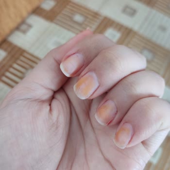 Flormar Oje Tırnakları Sararttı