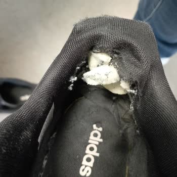 The Inside Of My Adidas Shoe Was Shattered...