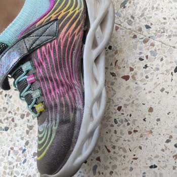 Skechers Ayıplı Ürünün Arkasında Durmuyorlar!