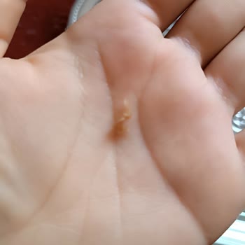 Çikolatanın İçinden Bez Parçasına Benzer Bir Şey Çıktı A101