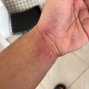 Puma Terlik Kalitesizliği Ve Ölüme Davetiyesi