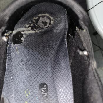 Skechers Ayakkabının İç Ve Dış Kısmı 6 Ay İçinde Deforme Oldu