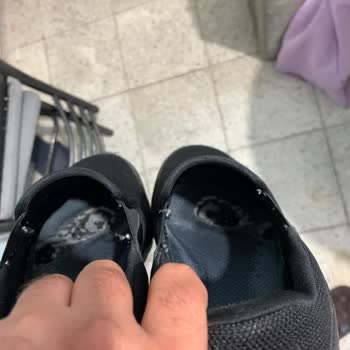 Skechers Ayakkabının İç Ve Dış Kısmı 6 Ay İçinde Deforme Oldu