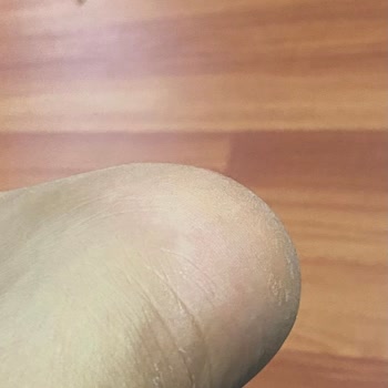 SuperStep Ürün Mağduriyeti, Değişim Veya İade Yapılmaması