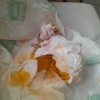 Sleepy Bebek Bezi Şikayet